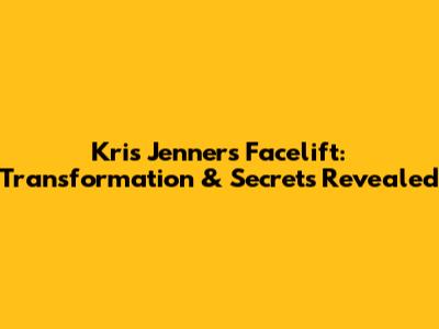 Kris Jenner's Facelift: Transformation & Secrets Revealed
